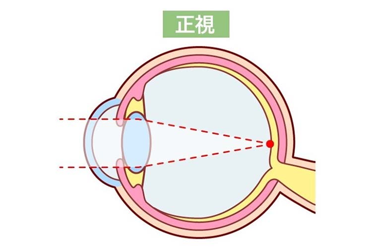 正視